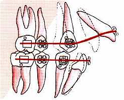 torque-fig1.jpg (11063 bytes)