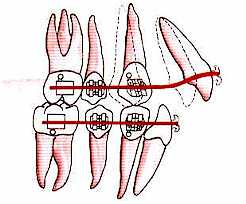 torque-fig2.jpg (10123 bytes)