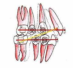 torque_fig3.jpg (10248 bytes)